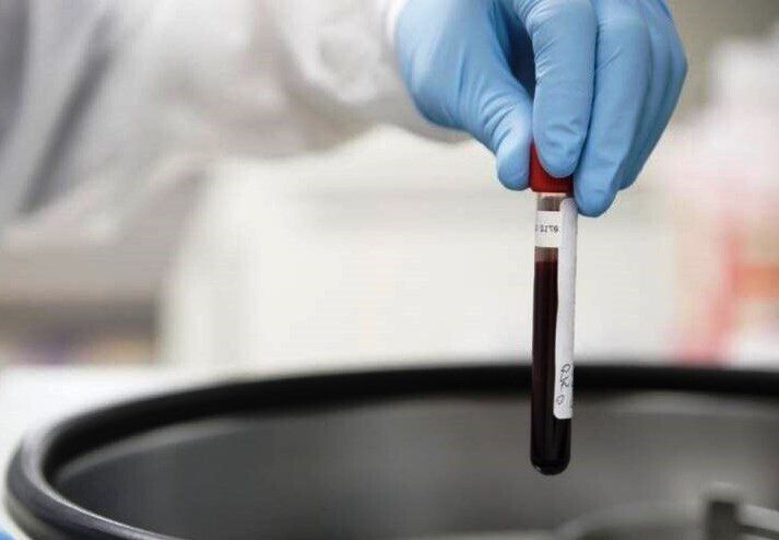 Норма сахара в крови у женщин после 60