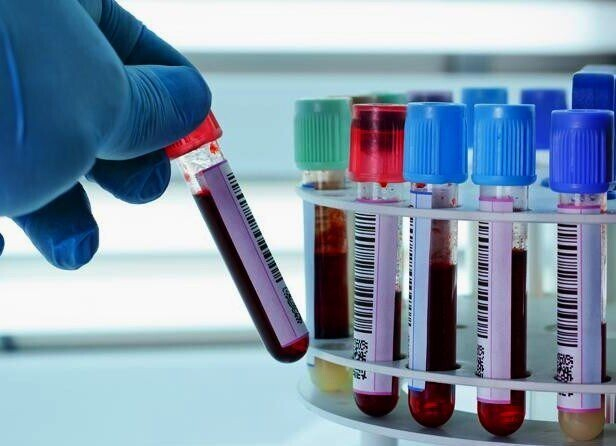 Норма лейкоцитов у мужчин по возрасту