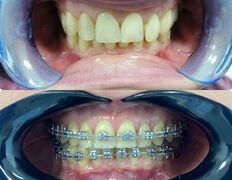 Стоматология Hiuldana Dental Clinic (Гюльдана Дентал Клиник, Гюльдана Дентал Клінік), Наши работы - фото 1