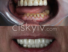 null Центр Ізраїльської стоматології (ЦIС), Примеры работ - фото 9