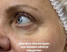 Клініка сучасної стоматології та косметології Космо-дент, Примеры работ - фото 1