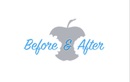Эндодонтия обычная — Стоматология «Before & after (Бефо энд Афтэ)» – цены - фото