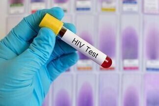 Бесплатный тест на ВИЧ в Украине: где и как его пройти
