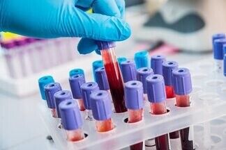 Ученые определили самую опасную группу крови
