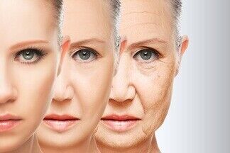 Как стареют разные типы лица, и что делать, чтобы замедлить этот процесс