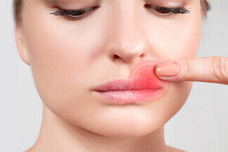 «Косметологические процедуры могут стать причиной герпеса на губах». Интервью с инфекционистом