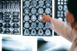 У головного мозку з'явився новий ворог — коронавірус. Розбираємося в усіх тонкощах МРТ