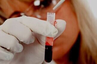 Биохимический анализ крови норма у взрослых