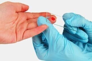 Лейкоциты: норма у детей по возрасту