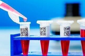 Кортизол: норма у женщин по возрасту