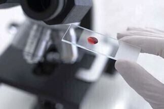 Общий белок в крови у женщин: норма по возрасту