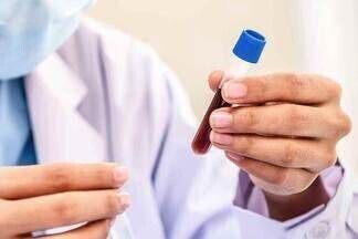 Гематокрит повышен у взрослого, о чем это говорит?