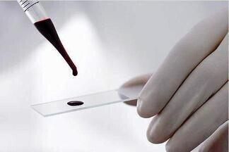 ФСГ в крови у женщин: норма по возрасту