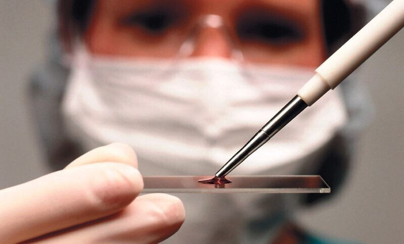 О чем говорит понижение тромбоцитов у взрослых О чем говорит понижение тромбоцитов у взрослых