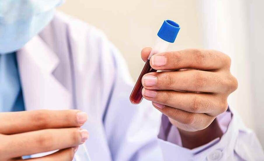 О чем говорит повышение гематокрита у взрослых