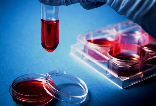 Норма гормонов щитовидной железы у женщин в таблице