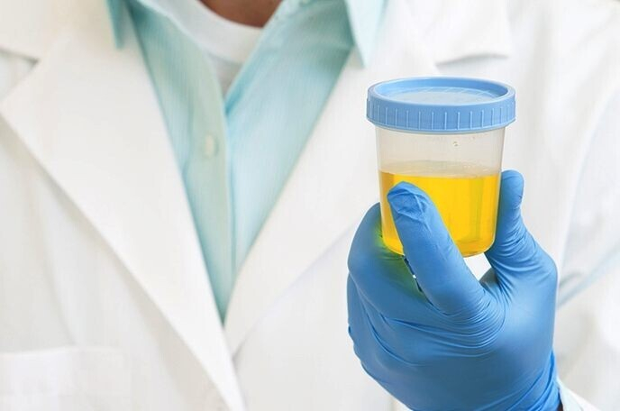 О чем говорят бактерии в моче