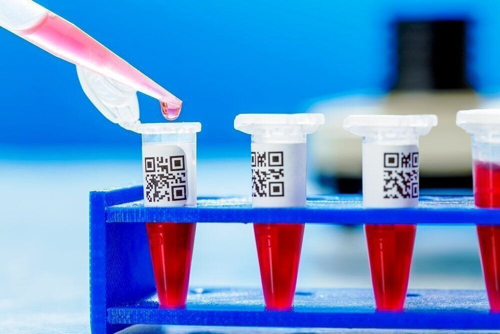 Кортизол: норма у женщин в таблице по возрасту