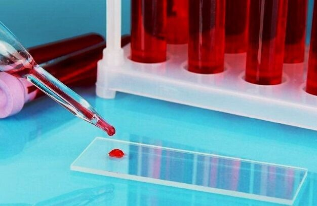 О чем говорит повышение тромбоцитов