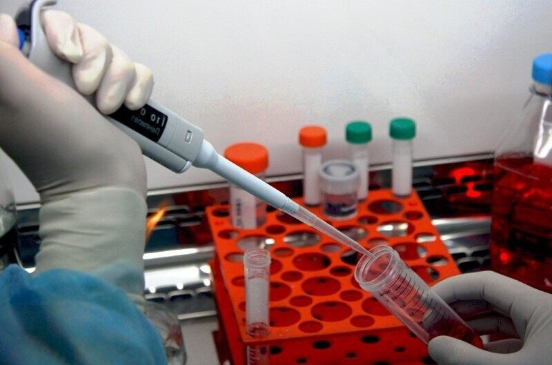 Повышенный креатинин в крови у мужчин: причины, лечение Повышенный креатинин в крови у мужчин: причины, лечение