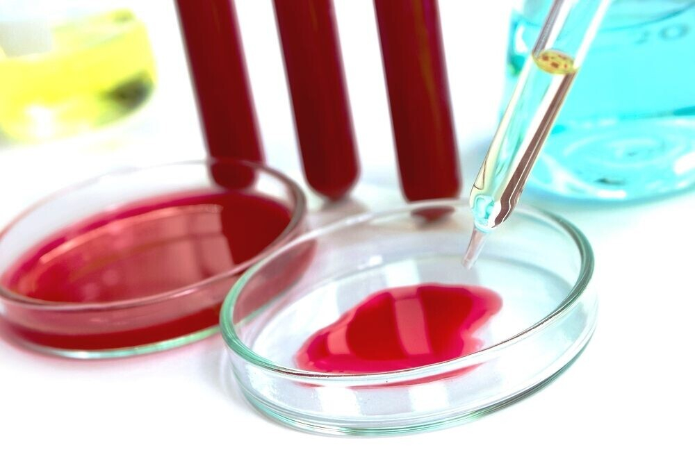 Причины повышения СОЭ по Вестергрену Причины повышения СОЭ по Вестергрену