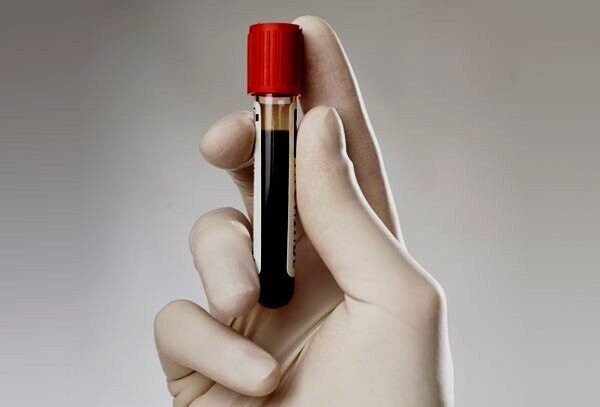 О чем говорит повышение моноцитов