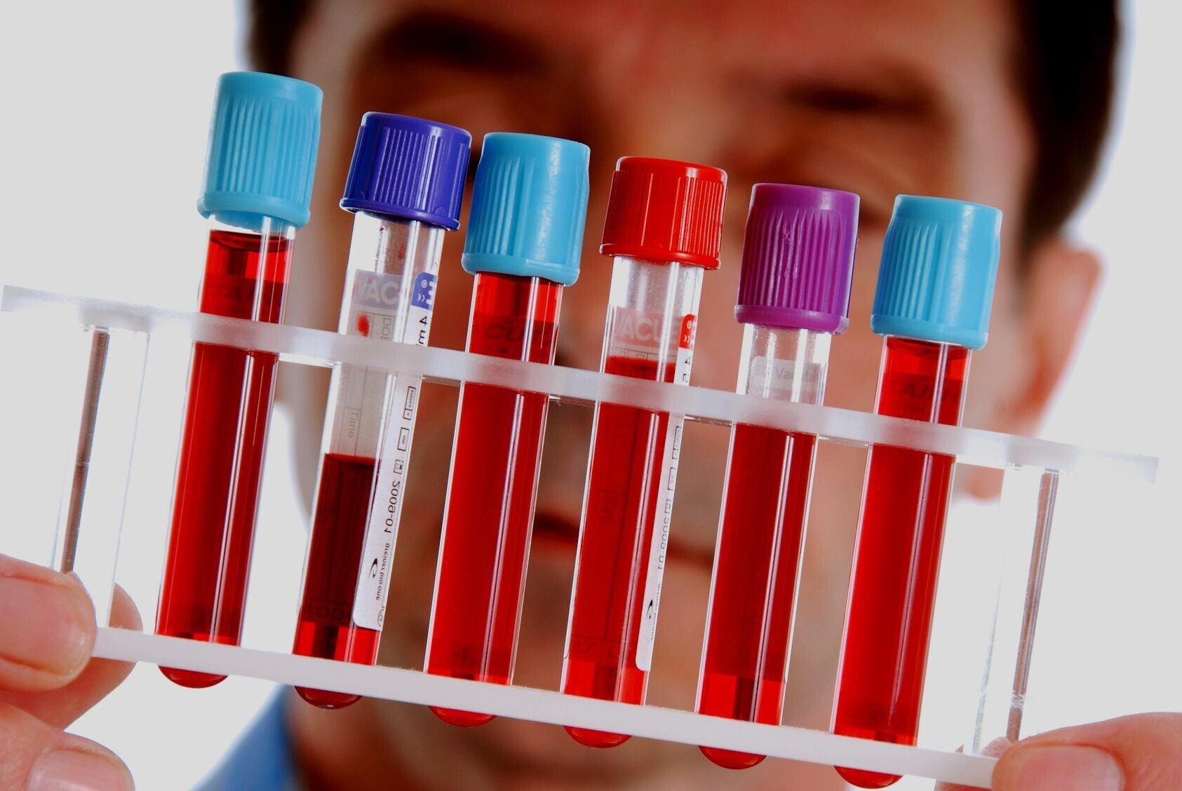 Антимюллеров гормон у женщин: норма в таблице по возрастам