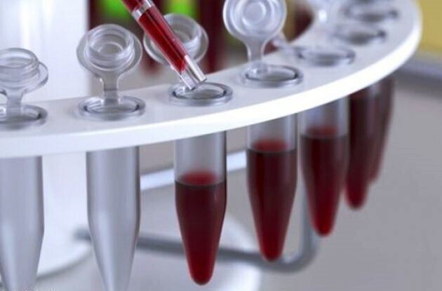 Норма пролактина у женщин в таблице во возрастам Норма пролактина у женщин в таблице во возрастам