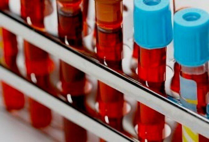 Норма ТТГ у женщин по возрасту в таблице Норма ТТГ у женщин по возрасту в таблице