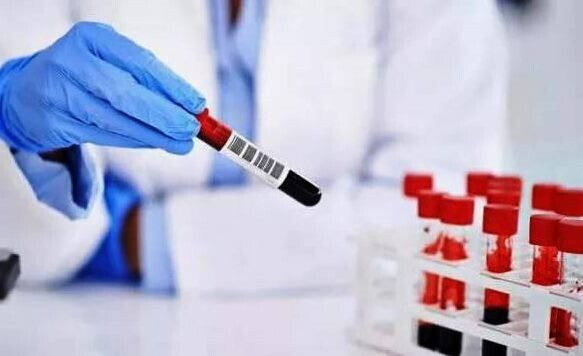 О чем говорят повышенные эритроциты у ребенка