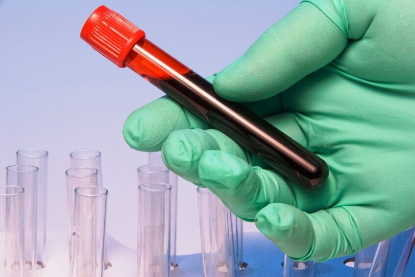 Повышенный пролактин у мужчин: признак и лечение Повышенный пролактин у мужчин: признак и лечение