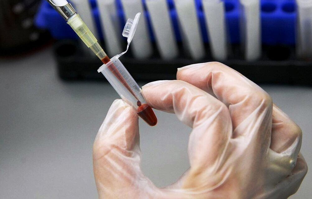 Норма гемоглобина у мужчин по возрастам Норма гемоглобина у мужчин по возрастам