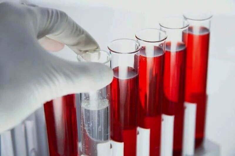 О чем говорит снижение моноцитов О чем говорит снижение моноцитов