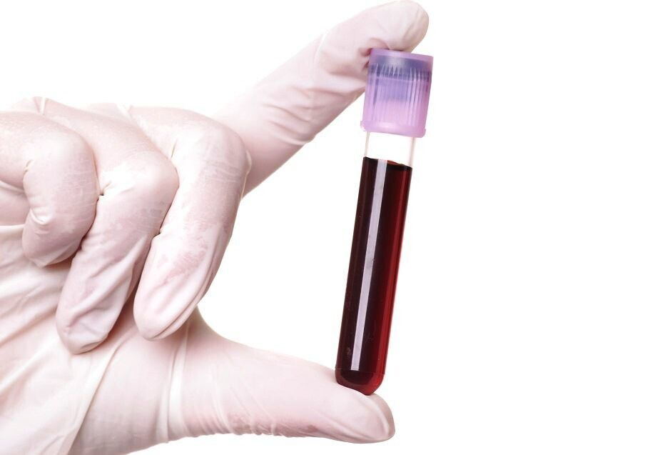 О чем говорит повышение эозинофилов