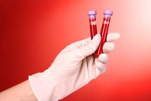 Норма эритроцитов у женщин по возрасту в таблице Норма эритроцитов у женщин по возрасту в таблице