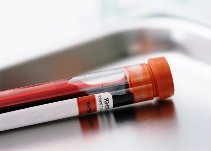 Причины пониженных нейтрофилов у взрослого