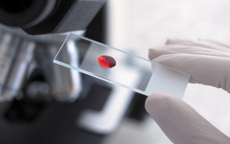 О чем говорит повышения гемоглобина у взрослых