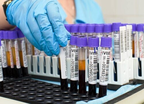 Норма билирубина в крови у мужчин по возрастам