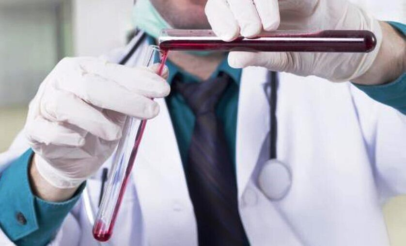 Норма прогестерона в таблице по возрастам и дням цикла