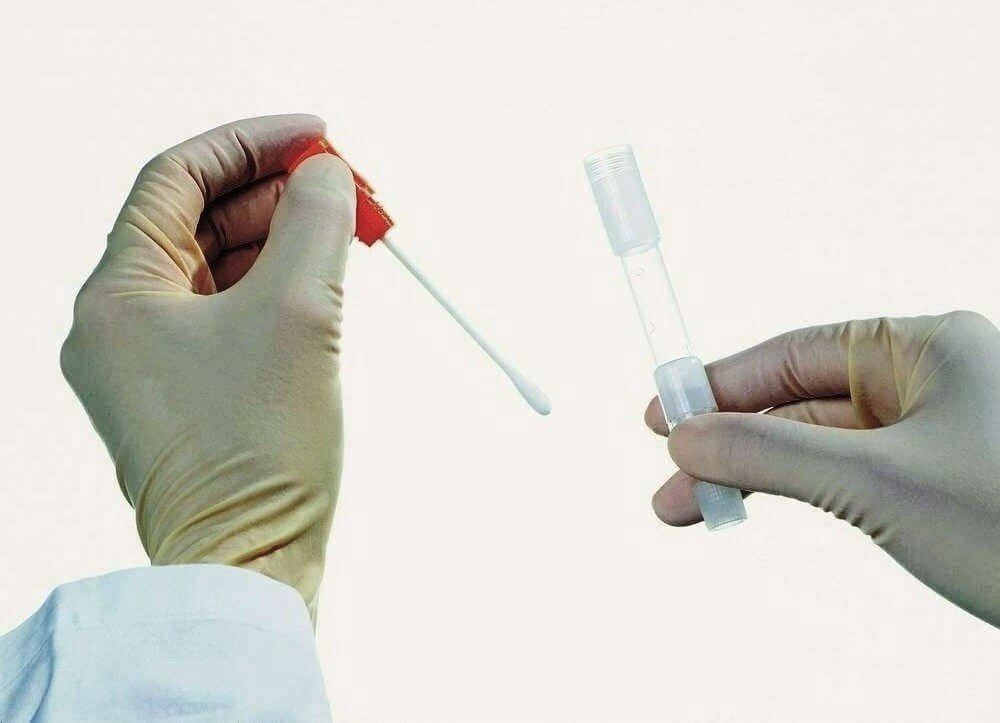 Мазок на флору у женщин: норма, расшифровка