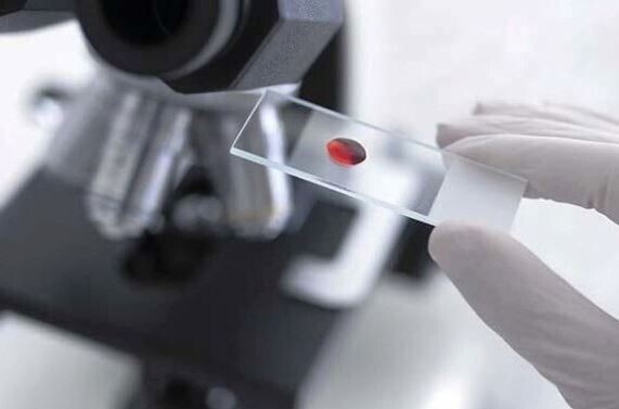 Таблица норм общего белка в крови у женщин по возрасту