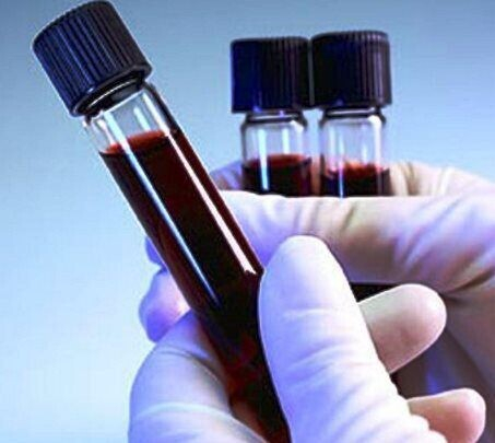 Причины повышенных тромбоцитов у взрослых