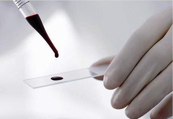 Таблица нормы ФСГ в крови у женщин по возрасту Таблица нормы ФСГ в крови у женщин по возрасту